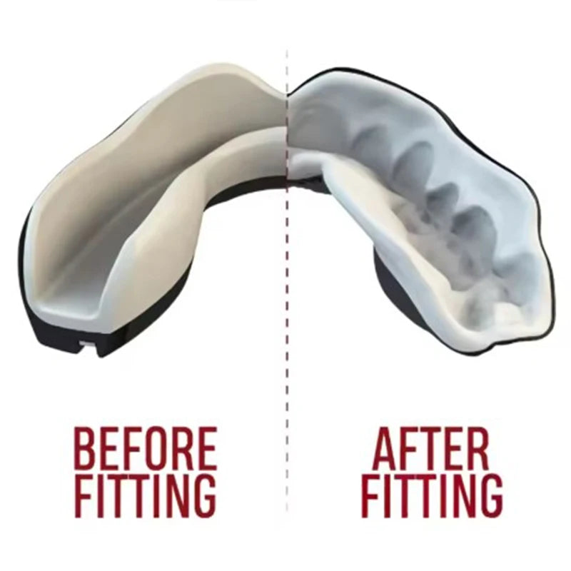 Protector bucal deportivo para adultos y niños; boxeo, muay thai, MMA, lucha y rugby